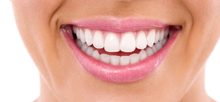 Perfect smile of a woman after teeth whitening in NYC.