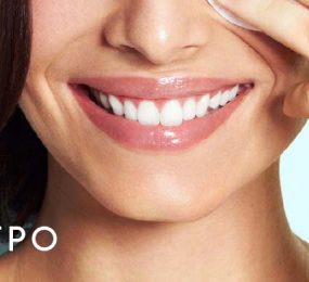 Beautiful woman's smile with perfect teeth.