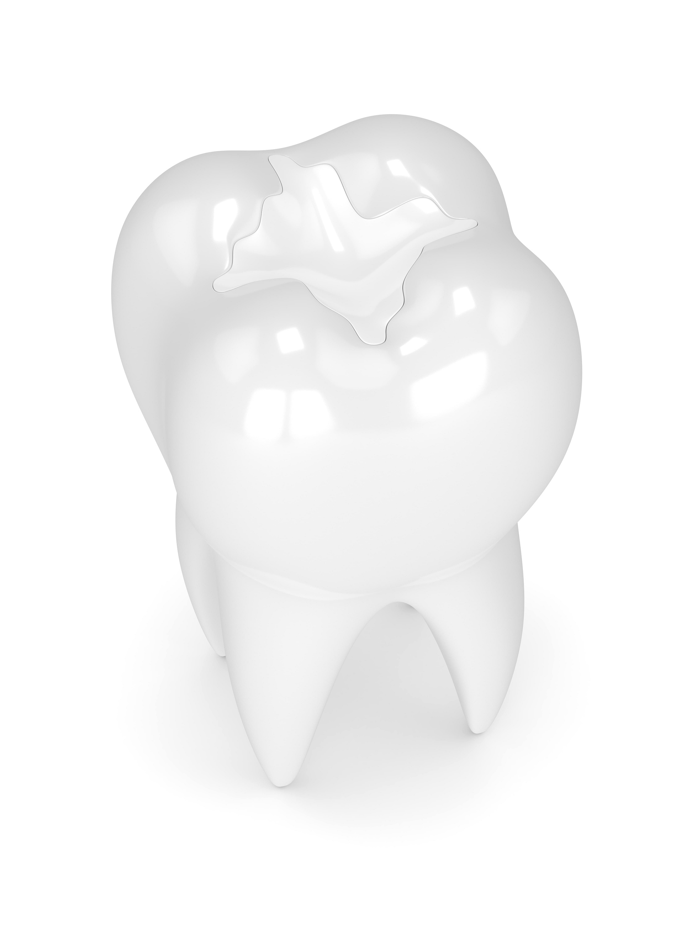 3D render of tooth.