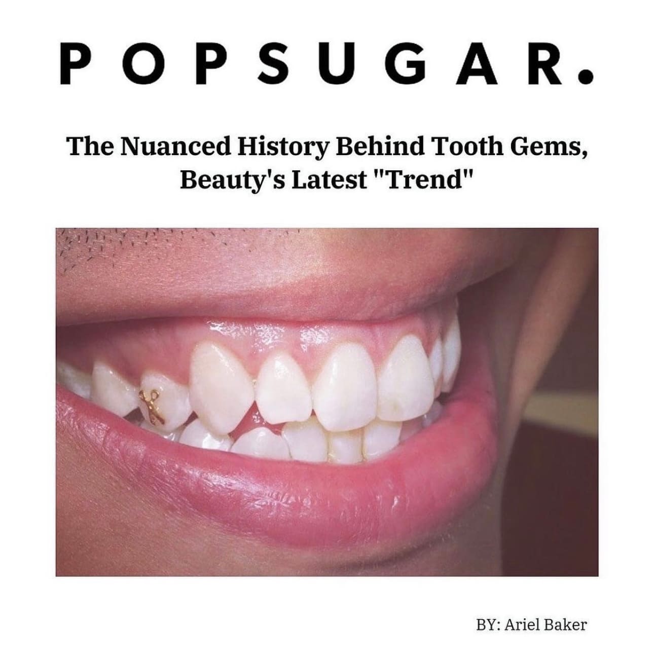 The Nuanced History Behind Tooth Gems, Beauty's Latest "Trend"