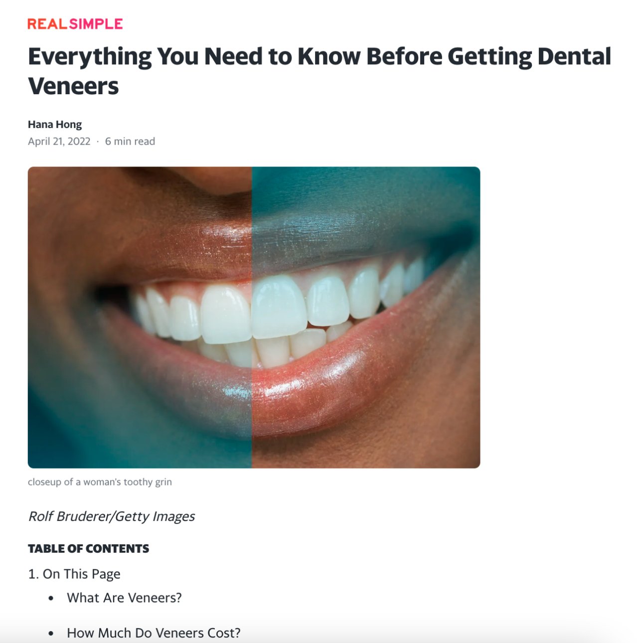 Screenshot of an article titled: Everything You Need to Know Before Getting Dental Veneers