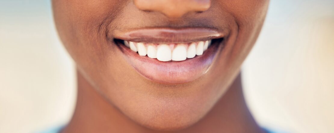 Closeup, mouth and woman with smile, teeth whitening and oral hygiene treatment with wellness. Person, outdoor or dental care with gum cleaning, veneers or orthodontics satisfaction with fresh breath